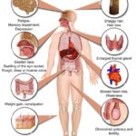 signs symptoms of hypothyroidism